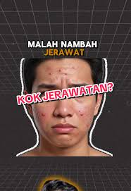 Tonton full videonua! Dan komen ya, review kalian buat facewash kami! ...