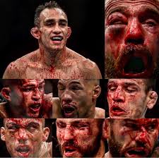 Latest on tony ferguson including news, stats, videos, highlights and more on espn. Fighting A Nightmare How Tony Ferguson Terrorised The Lightweight Division The Fight Site
