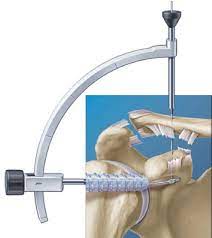 Arthroskopische Schultereingriffe Deutsches Schulterzentrum