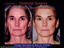 Home Dr Dean Kane Center For Cosmetic Surgery Medispa Cosmetic Surgery Cosmetic Medicine Medispa