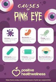 6 Causes Of Pink Eye Conjunctivitis Positive Health Wellness Infographic Pink Eye Causes Pink Eyes Eye Health