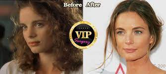 Sections show more follow today plastic surgery might not only help make people. Gabrielle Anwar Plastic Surgery