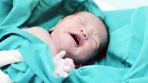 Aus medizinischer sicht ist das vollkommen unbedenklich. Vietnam Baby Kommt Mit Spirale In Der Hand Zur Welt Brigitte De