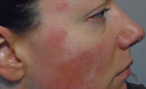 Your Complete Guide To Near Infrared Light Therapy Red Light Therapy Red Light Therapy Red Light Therapy Benefits Light Therapy