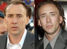 Did steve carell get a hair transplant. Famous Celebrity Hair Transplants Ak Clinics