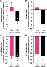 Image result for Silver Grey 1995 AAV