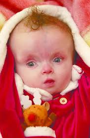 'Little Angel' sees her first Christmas