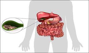 Fresh zucchini spoils fairly quickly, whether you get them from the grocery store or grow your own. Diet Chart For Gall Stones Foods To Consume And Avoid In Gall Stones
