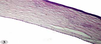 Epithelial basement membrane dystrophy is h18.59 only. Cornea Of Control Group Showing The 5 Layers Of Cornea Epithelium Download Scientific Diagram