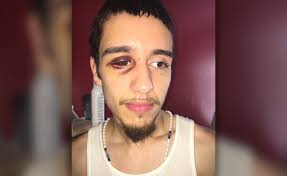 Lawsuit names second NYPD cop in alleged Coney Island beating