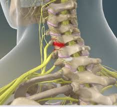 Image result for Radiofrequency Surgery