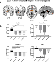 The ultimate police resource for interrogation news, expert analysis, and videos from the law enforcement community. Neural Correlates Of Anxiety Under Interrogation In Guilt Or Innocence Contexts