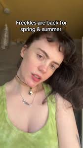 Embrace Your Freckles This Spring and Summer