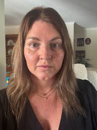 Can I get hair colour done after packet dye?