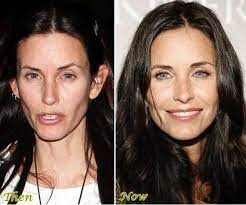 It's more than just breast augmentation and rhinoplasty. Pin On Nip Tuck