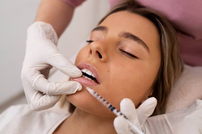 The Ultimate Guide to Lip Filler Trends - Hush LA Medspa