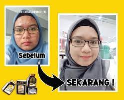 > sesuai untuk lelaki & wanita extra skin white , adalah kapsul yang diperkaya dengan ekstrak sakura, bunga unik yang berasal dari jepun. Extra Skin White Esw Empire Posts Facebook