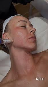 Join us in congratulating Dr. Neil Fine