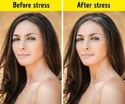 Research has found that people with prematurely graying hair also tend to have vitamin d deficiencies. Scientists Explain The Reasons For Graying Hair And Ways To Slow The Process Down