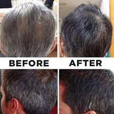 Here are 3 of the best shampoo to darken gray hair: Buy Natural Hair Darkening Shampoo And Conditioner Organic Hair Darkening Shampoo Bar Volumizing Moisturizing Black Hair Shampoo For Women Men Grey Hair 200ml Online In Taiwan B085xj4hd5