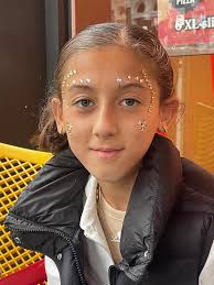 manisha morgan is fundraising for Ichthyosis Support Group