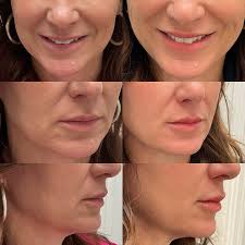 Abby Lape FNP-C (@lipsbylape) • Instagram photos and videos