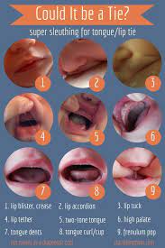 Mother S Intuition When Breastfeeding Isn T Easy Baby Tongue Baby Health Breastfeeding