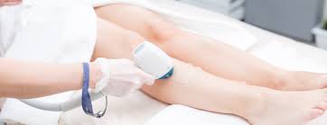 I started by getting a groupon and then just continued. Laser Hair Removal Conditions Treatments Ucsf Health