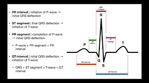 Image result for PR Interval