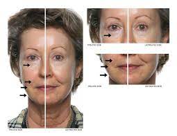 Ageloc Edition Nuskin Galvanic Spa System Ii The Beauty Guide