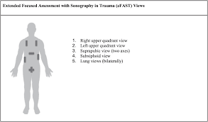 Image result for Trauma Evaluation