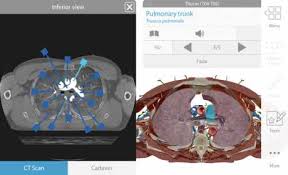 ★ you can rotate models to any angles and zoom in and out. Human Anatomy Atlas 2019 Complete 3d Human Body 2020 0 73 Apk Mod Unlocked Iaps Data Android
