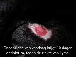 Niet alle besmette personen ontwikkelen de ziekte van lyme. Hond Met Ziekte Van Lyme Na Tekenbeet Youtube