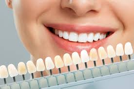 Smile Makeover Procedures, Benefits, and What to Expect | Clear Choice  Dental