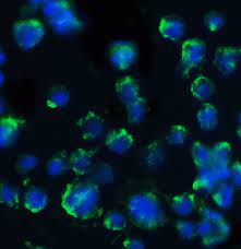BACE Antibody - Cat. No. 2253 | ProSci
