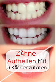 Pin Von Sabine Flegel Auf Beauty Zahne Aufhellen Hausmittel Zahne Und Schonheitstricks