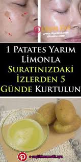 Gunes Lekesi Ve Cilt Lekeleri Icin Dogal Maskeler Gunes Lekesi Ve Cilt Lekeleri Icin Dogal Maskeler Diy Unhas Fotos Diy