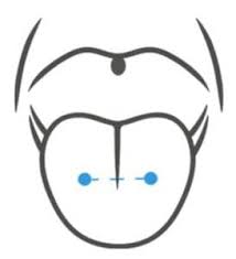 Maybe you would like to learn more about one of these? Venom Piercing Die Richtige Pflege Prontolind De