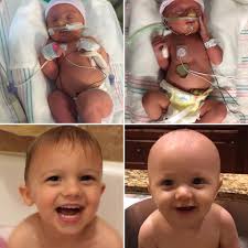 Hundreds of parents have shared their real-life preemie stories in the days  since This Is Us launched its touching prematurity/NICU storyline. Your  story has the power to connect, heal and inspire. Share