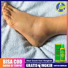 Kondisi ini bisa disebabkan oleh berbagai hal, mulai dari terlalu lama dengan mengetahui penyebab kaki bengkak, penanganan dapat dilakukan dengan tepat. Obat Kaki Bengkak Kaki Bengkak Karena Diabetes Minyak Sapu Jagat 100 Alami Shopee Indonesia