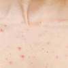 What are the symptoms of a breast tumor? Https Encrypted Tbn0 Gstatic Com Images Q Tbn And9gcru Uakikom0oqgsuumimwjbrc G 0ekbhcfb6zlkw4fotdnrpg Usqp Cau