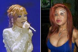 Myl ne farmer torrents for free, downloads via magnet also available in listed torrents detail page, torrentdownloads.me have largest bittorrent database. Mylene Farmer Meconnaissable Apres Sa Chirurgie Esthetique