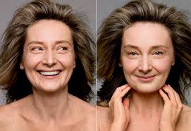 Squeeze a small amount of tretinoin (roughly the size of a pea) onto your finger and gently apply the medication to your forehead, cheeks, chin and other areas of your face. Skin Firming Treatments Plastic Surgery Alternatives Aging Skin