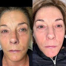 Dr. Abby Friend DAc, LAc. (@themodernacupuncturist) · Instagram 照片和视频