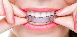For others, they may have to replace them every 6 months. Invisalign Retainers A Complete Guide