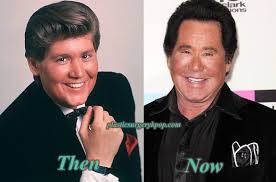 Wayne newton was confirmed for getting plastic surgery for his aging face during an episode of the bachelorette. Wayne Newton Bad Plastic Surgery Before And After Pictures