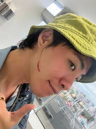 I Think I Look Quite Badass Now”: Zong Zijie Gets 10cm Cut On His Cheek  While Filming New Mediacorp Drama