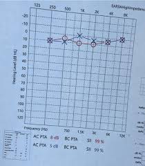 Image result for Audiogram
