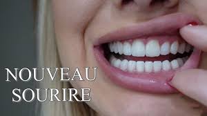 We did not find results for: Admin Dental Implant Hollywood Smile Crown Dental Travel Veneer In Turkey