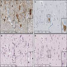 Mark2 And Tau Interact Throughout The Process Of Nft Formation In Ad Download Scientific Diagram